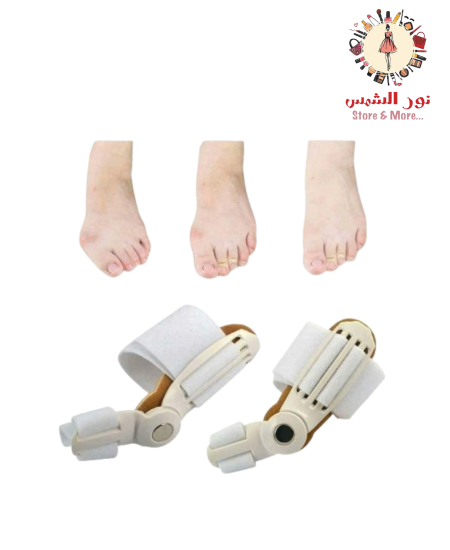 جهاز تقويم انحراف عظام الاصابع
